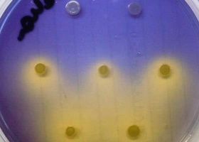 Agroindustria actualizó la normativa en biotecnología microbiana