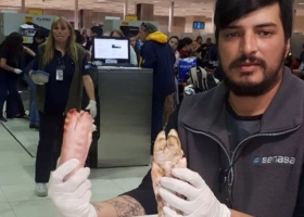 Insólito: en pleno brote asiático de la peste porcina africana un ciudadano chino intentó ingresar a la Argentina una valija con seis patas de cerdo
