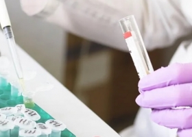 Lanzarán al mercado un test de detección rápida de Covid-19: cuándo estará disponible para la venta