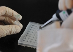 Cómo la edición de genes permitió eliminar la "vaca loca"